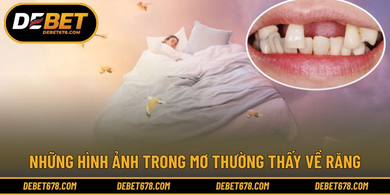 Những hình ảnh trong mơ thường thấy về răng